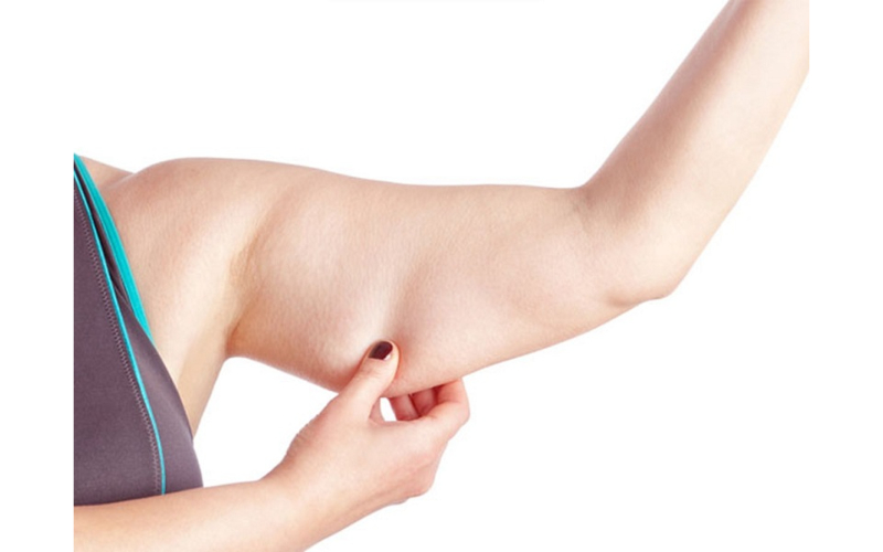 Quá trình giảm mỡ bắp tay cần lưu ý một số điểm nhất định