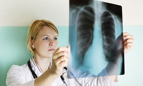 Thực hư sự lây nhiễm của bệnh nám phổi
