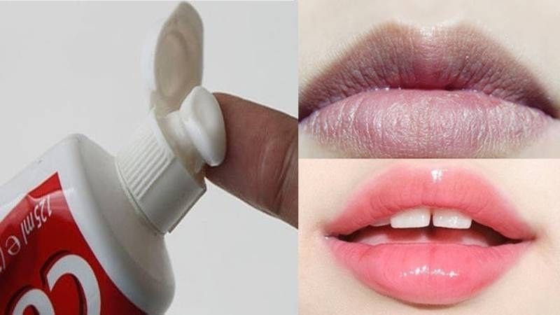 Dùng kem đánh răng chống thâm môi hiệu quả