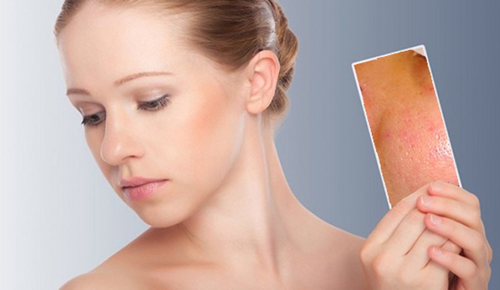           Vệ sinh da mặt không đúng cách khiến da mặt bạn bị nổi mụn nhiều