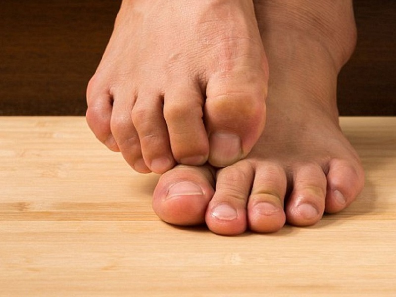 Vi khuẩn là nguyên chính dẫn đến mụn ở chân