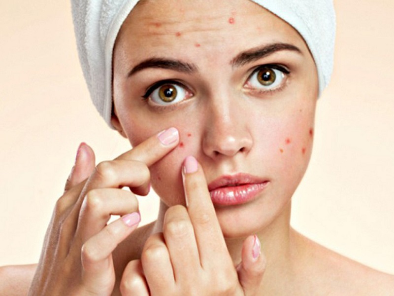 Bạn có thể áp dụng những bước chăm sóc da thường ngày trong khi sử dụng thuốc đặc trị