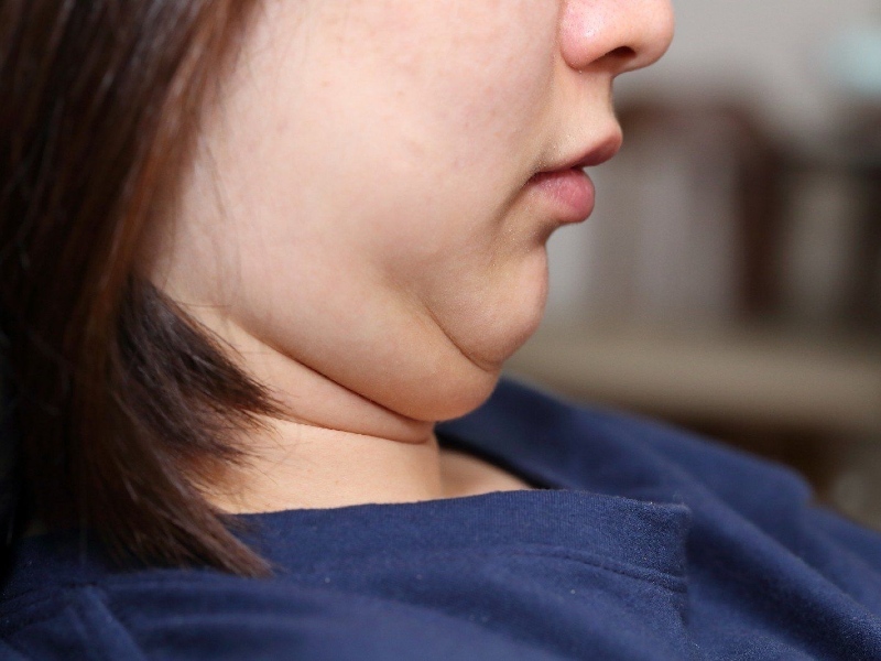 Các tư thế xấu có thể khiến vùng da quanh cổ mất tính đàn hồi