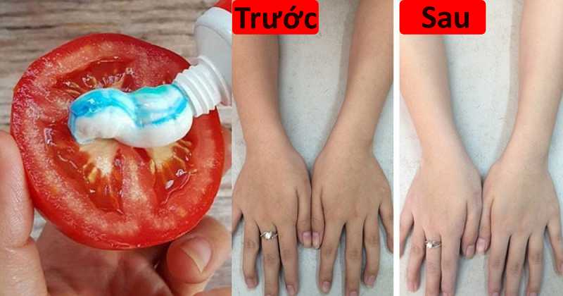Cà chua với kem đánh răng có thể giúp làm trắng da