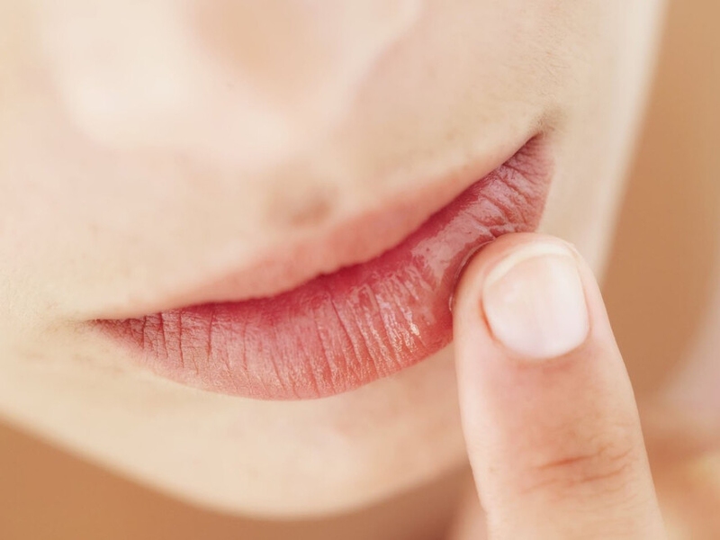 Việc chạm tay vào môi có thể khiến vi khuẩn từ tay dễ dàng đi vào môi, gây viêm nhiễm thậm chí là mưng mủ